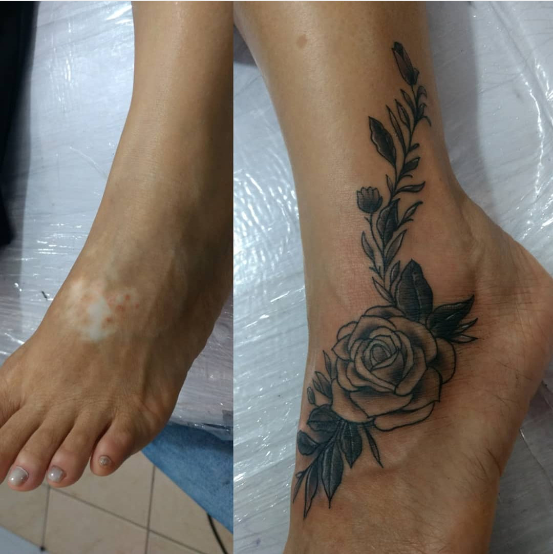 Imagem Com Tatuagem De Flor No Pé Cobrindo Cicatriz