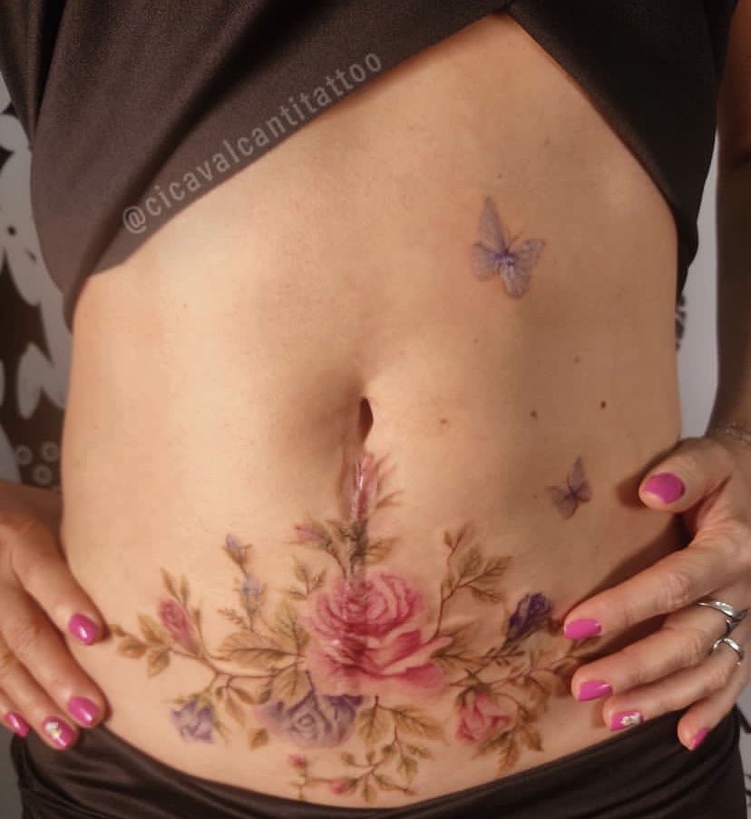 Imagem Com Tatuagem Feminina Grande Para Cobertura De Cicatrizes