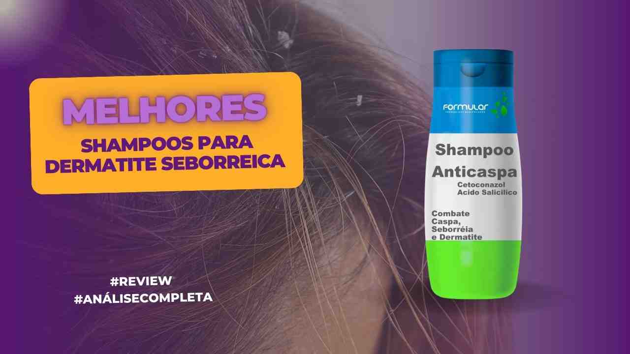 Melhores Shampoos para Dermatite Seborreica
