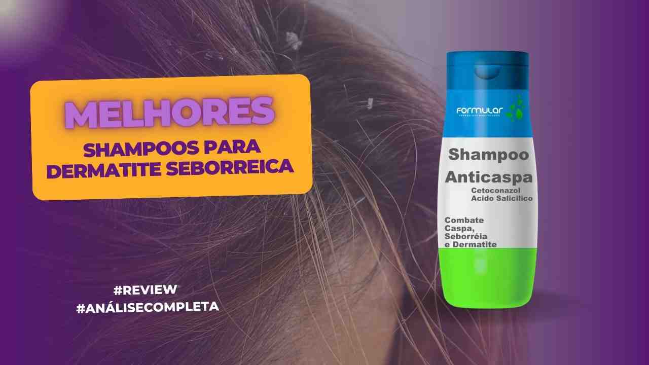 TOP 7 Melhores Shampoos para Dermatite Seborreica! Veja! 2024