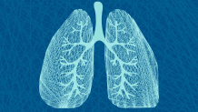 Fibrose cística: sintomas, causas e tratamento